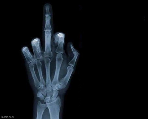 xray finger | image tagged in xray finger | made w/ Imgflip meme maker