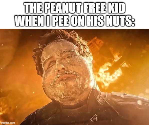 *dies from allergy* | THE PEANUT FREE KID WHEN I PEE ON HIS NUTS: | image tagged in peter quill swollen face,allergies,marvel,guardians of the galaxy,deez nuts,oof | made w/ Imgflip meme maker