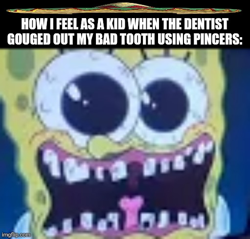 HOW I FEEL AS A KID WHEN THE DENTIST GOUGED OUT MY BAD TOOTH USING PINCERS: | image tagged in memes,teeth,dentist | made w/ Imgflip meme maker