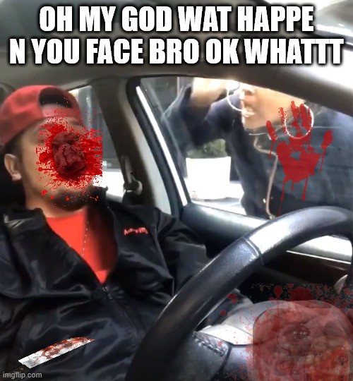 My funy Funy FUNNNNYY meme | OH MY GOD WAT HAPPE N YOU FACE BRO OK WHATTT | image tagged in stfu im listening to | made w/ Imgflip meme maker