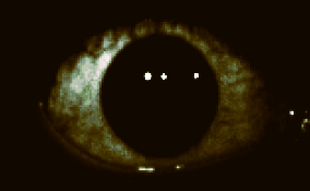 eye Blank Meme Template