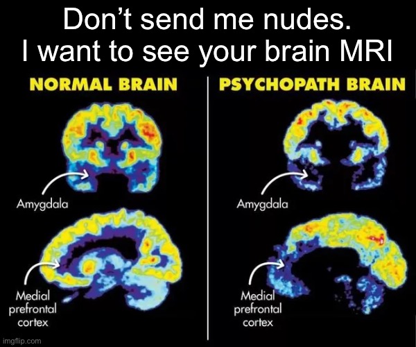 Brain Scans | Don’t send me nudes.
I want to see your brain MRI | image tagged in psychopath,normal,mri,scans | made w/ Imgflip meme maker