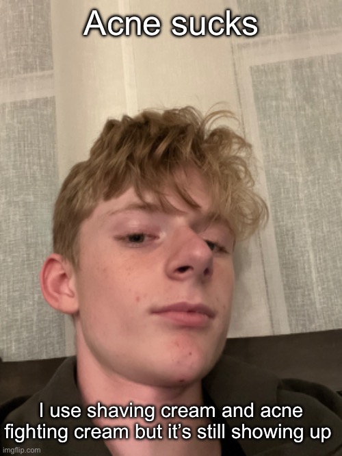 Hair messy af | Acne sucks; I use shaving cream and acne fighting cream but it’s still showing up | made w/ Imgflip meme maker