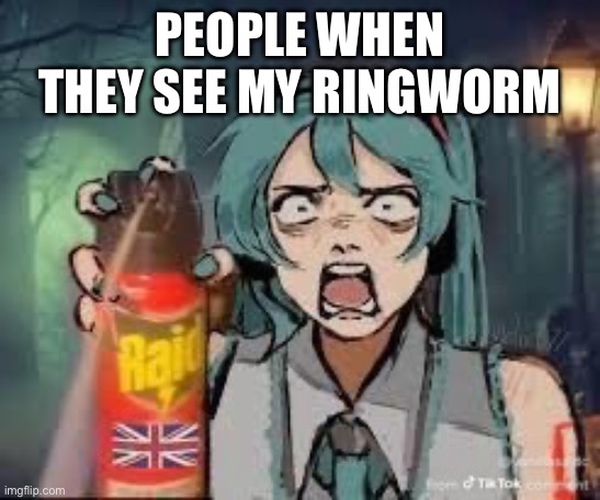 Hi | PEOPLE WHEN THEY SEE MY RINGWORM | image tagged in hi | made w/ Imgflip meme maker