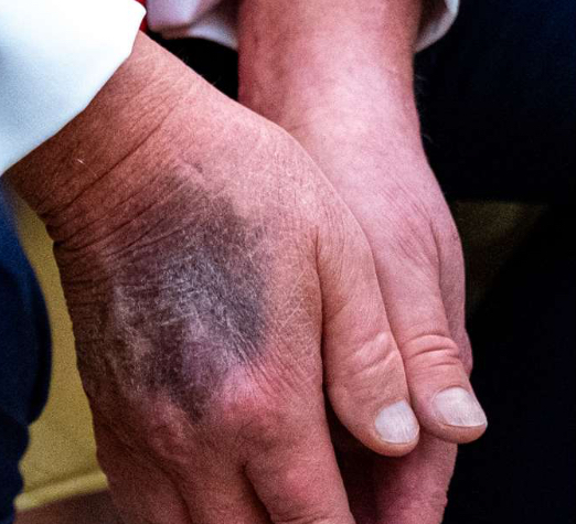 Trump hands Blank Meme Template