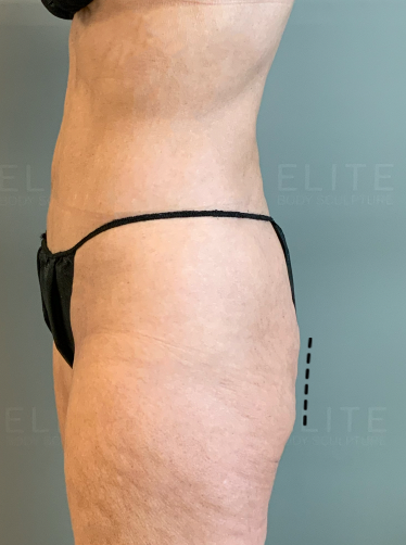 Pancake booty Blank Meme Template