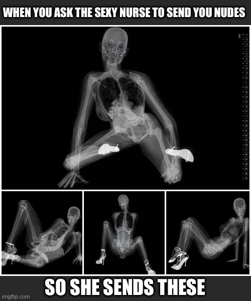 Send nudes please (warning: very intimate images) | WHEN YOU ASK THE SEXY NURSE TO SEND YOU NUDES; SO SHE SENDS THESE | image tagged in nudes,nurses,joker nurse,xray,send nudes | made w/ Imgflip meme maker