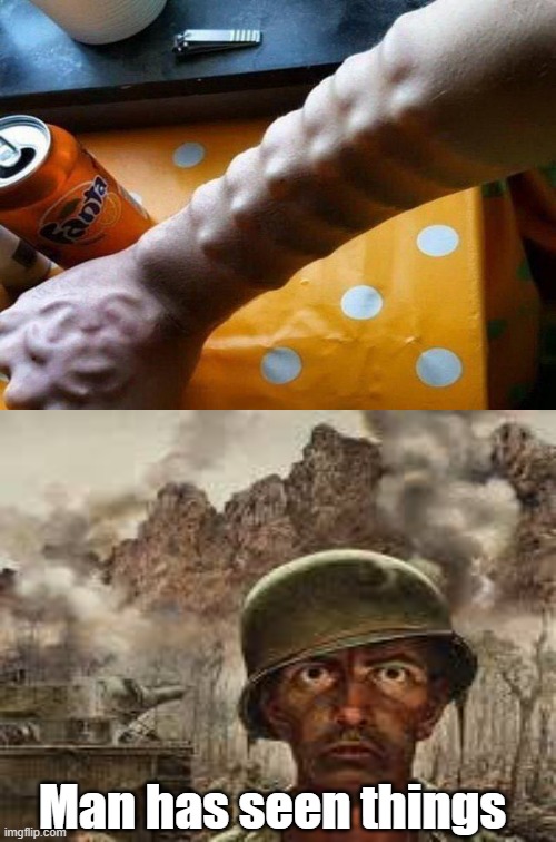 Man has seen things | Man has seen things | image tagged in radiation,cursed image | made w/ Imgflip meme maker