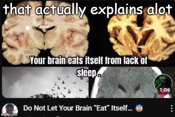 brain | that actually explains alot | image tagged in brain | made w/ Imgflip meme maker