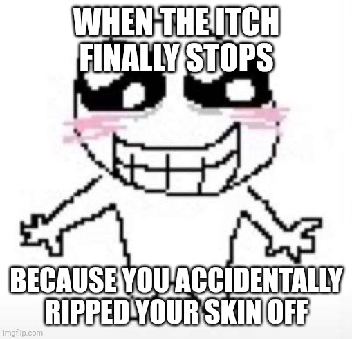 Yay | WHEN THE ITCH FINALLY STOPS; BECAUSE YOU ACCIDENTALLY RIPPED YOUR SKIN OFF | image tagged in yay | made w/ Imgflip meme maker