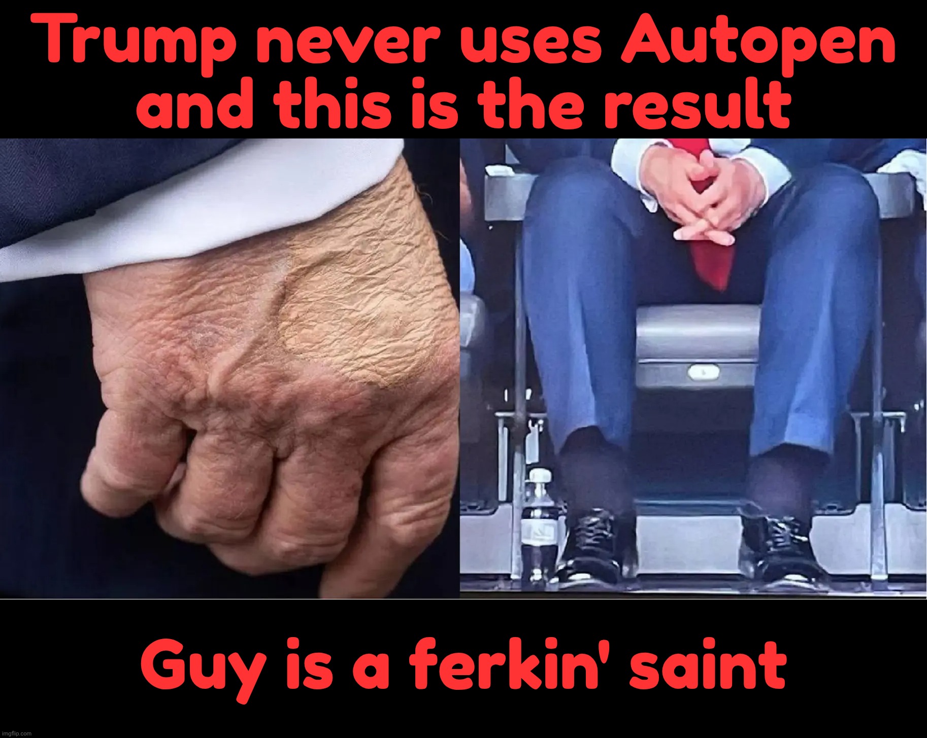Trump cankles and bruised hand makeup | Trump never uses Autopen
and this is the result Guy is a ferkin' saint | image tagged in trump cankles and bruised hand makeup | made w/ Imgflip meme maker