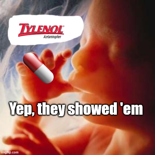 Fetus | Yep, they showed 'em | image tagged in fetus | made w/ Imgflip meme maker