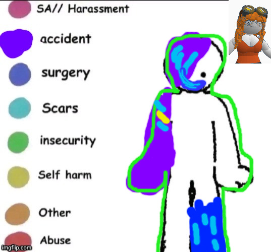 Maeve MacGowan's pain chart | image tagged in pain chart | made w/ Imgflip meme maker