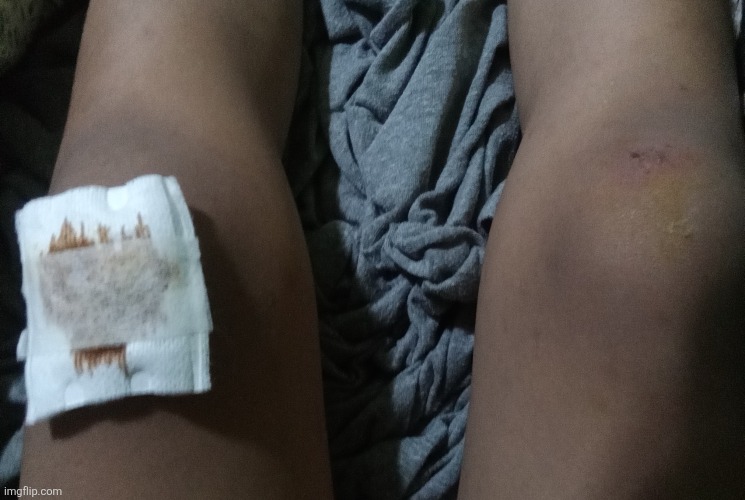 Got injured | made w/ Imgflip meme maker