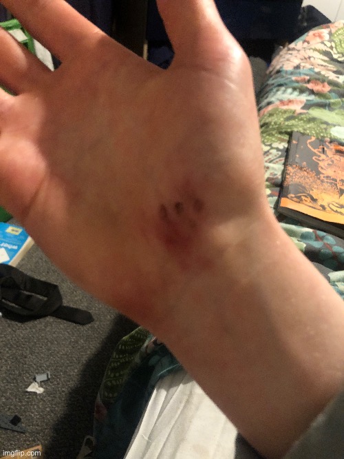 Some shotgun pellets grazed my hand today | made w/ Imgflip meme maker