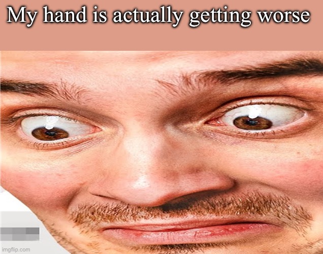 what the fuck am i seeing | My hand is actually getting worse | image tagged in what the fuck am i seeing | made w/ Imgflip meme maker