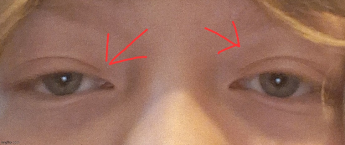 Why is one of my eyes lower than the other | made w/ Imgflip meme maker