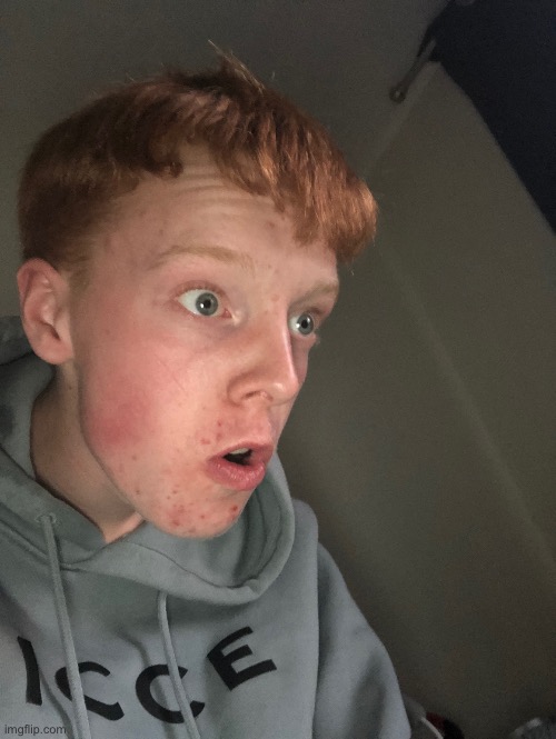 Feel free to roast or caption ts | image tagged in neuron activation | made w/ Imgflip meme maker