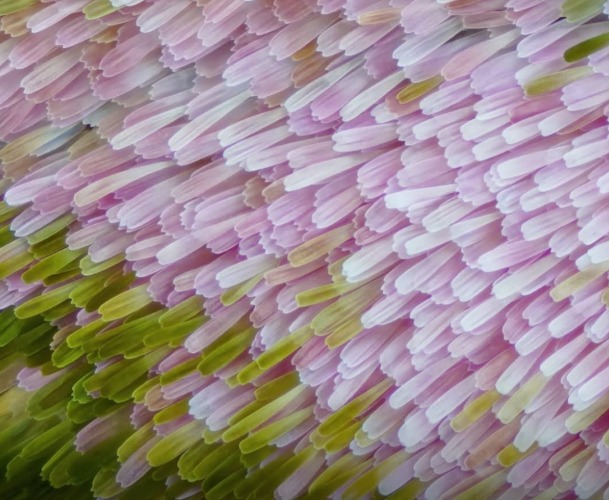 Can you guess what this is? | image tagged in hint insect under the microscope | made w/ Imgflip meme maker