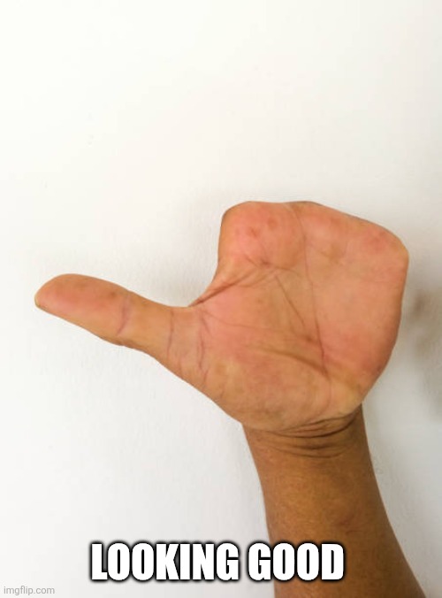 Missing fingers | LOOKING GOOD | image tagged in missing fingers | made w/ Imgflip meme maker