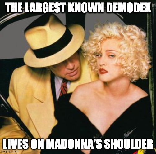 largest known demodex | THE LARGEST KNOWN DEMODEX; LIVES ON MADONNA'S SHOULDER | image tagged in madonna,dick tracy,demodex | made w/ Imgflip meme maker
