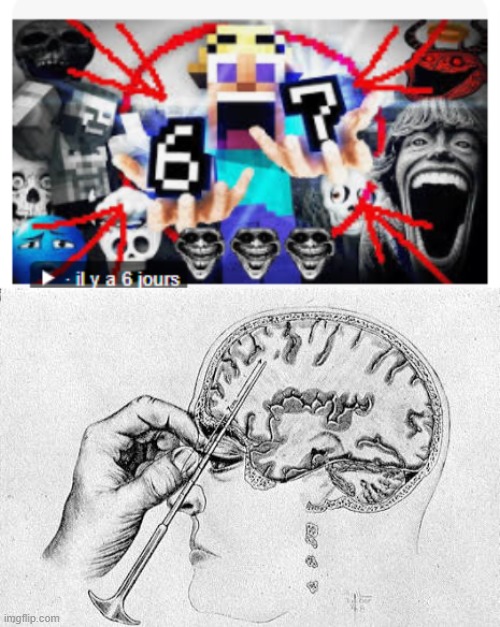 image tagged in lobotomy | made w/ Imgflip meme maker