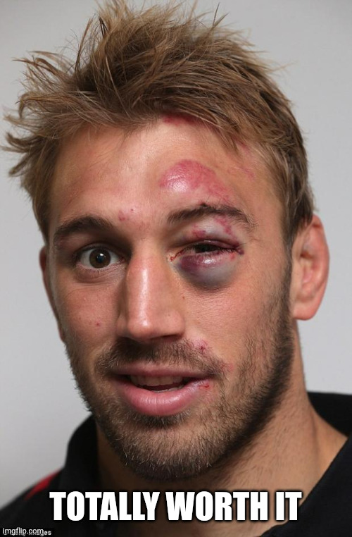 black eye | TOTALLY WORTH IT | image tagged in black eye | made w/ Imgflip meme maker