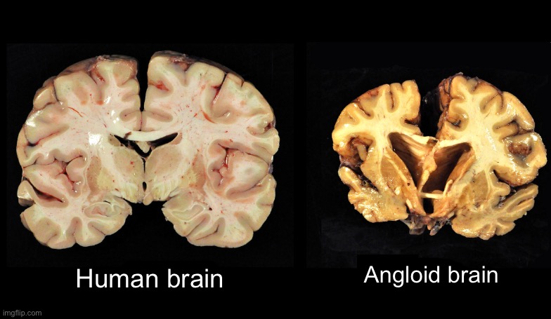 Angloid brain; Human brain | made w/ Imgflip meme maker