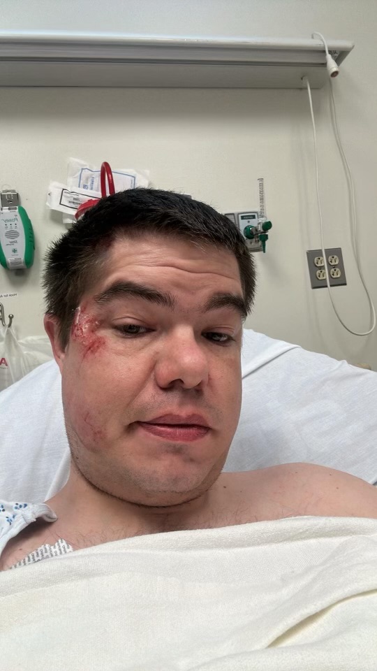 Bitch Blank Meme Template