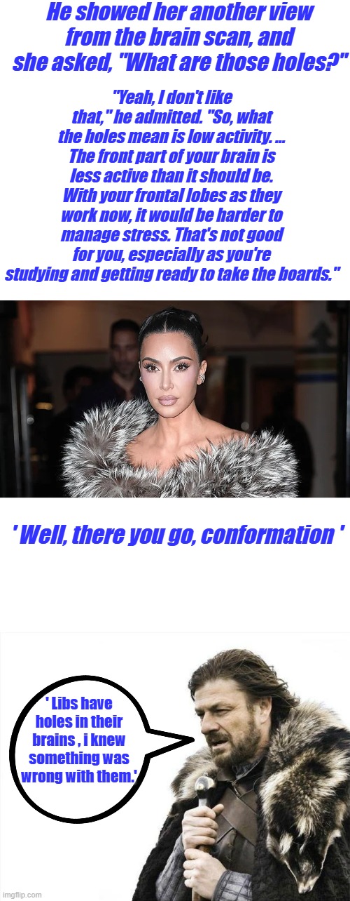 Must be why they want ' Safe zones ' everywhere they go. Might be why they never grow up also. Trust the Science. | He showed her another view from the brain scan, and she asked, "What are those holes?"; "Yeah, I don't like that," he admitted. "So, what the holes mean is low activity. … The front part of your brain is less active than it should be. With your frontal lobes as they work now, it would be harder to manage stress. That's not good for you, especially as you're studying and getting ready to take the boards."; ' Well, there you go, conformation '; ' Libs have holes in their brains , i knew something was wrong with them.' | image tagged in memes,brace yourselves x is coming | made w/ Imgflip meme maker