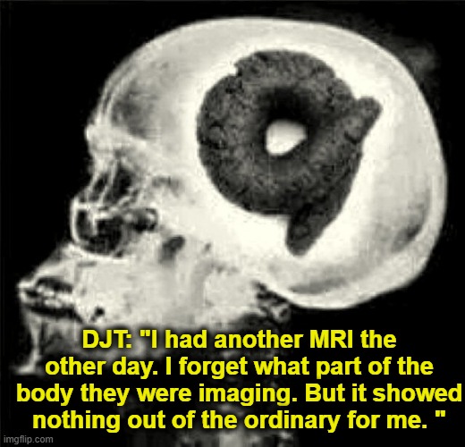 tRump's MRI | DJT: "I had another MRI the other day. I forget what part of the body they were imaging. But it showed nothing out of the ordinary for me. " | image tagged in trump meme,president trump,presidential alert,maga,nevertrump,donald trump is an idiot | made w/ Imgflip meme maker