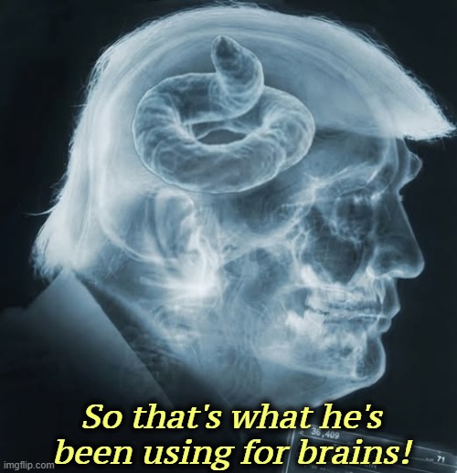Aren't MRI's amazing? | So that's what he's been using for brains! | image tagged in trump's mri shit for brains,trump,mri,brain,mental illness,senile dementia | made w/ Imgflip meme maker