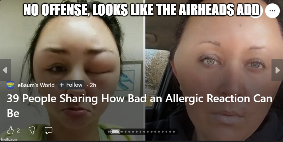 Airheads add | NO OFFENSE, LOOKS LIKE THE AIRHEADS ADD | image tagged in big head | made w/ Imgflip meme maker