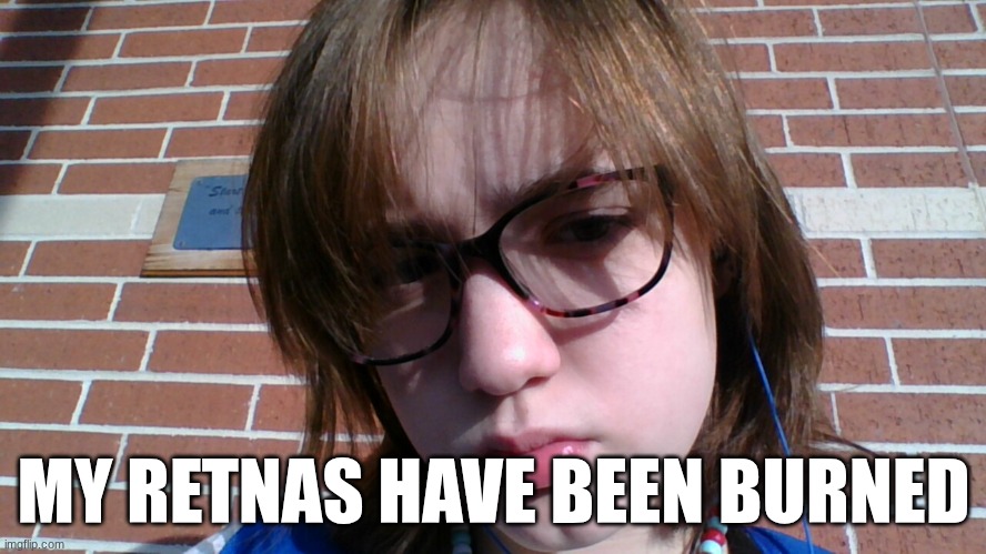 MY RETNAS HAVE BEEN BURNED | made w/ Imgflip meme maker
