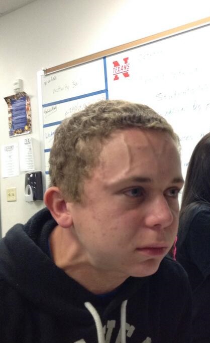 Mec avec veine sur le front concentré Blank Meme Template