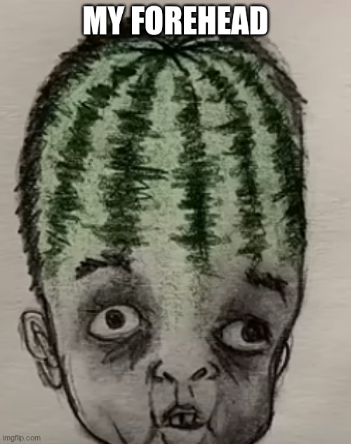 me irl | MY FOREHEAD | image tagged in memes | made w/ Imgflip meme maker