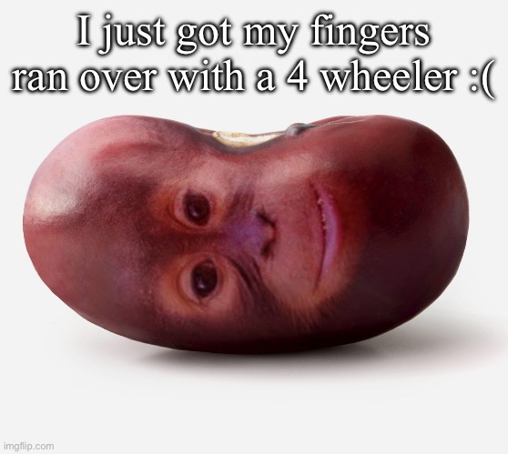 Primate | I just got my fingers ran over with a 4 wheeler :( | image tagged in primate | made w/ Imgflip meme maker