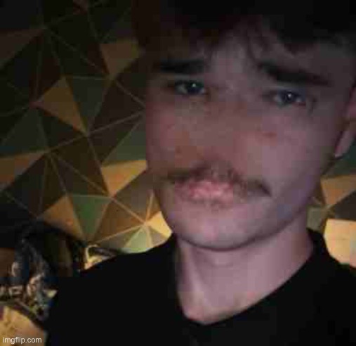 Image of me this is my face revel i was in a care crash | image tagged in image of me this is my face revel i was in a care crash | made w/ Imgflip meme maker