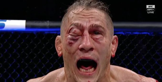 mma Blank Meme Template