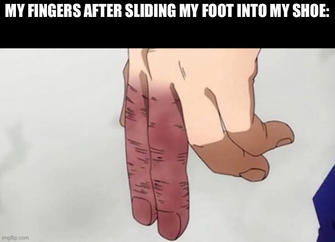 They hurt SOO MUCH | MY FINGERS AFTER SLIDING MY FOOT INTO MY SHOE: | image tagged in memes,funny,funny memes,relatable,finger,fun | made w/ Imgflip meme maker