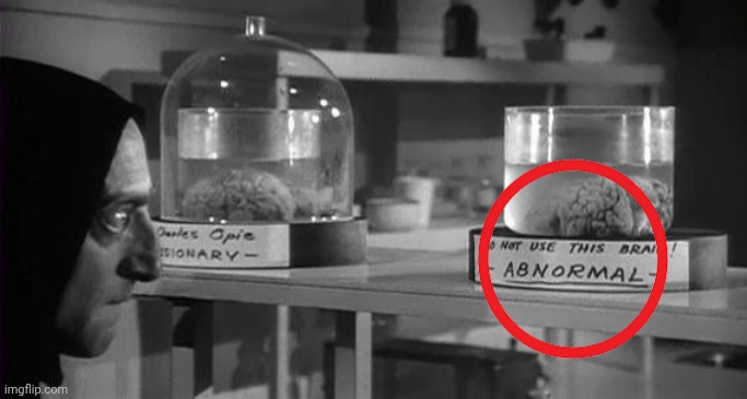 Abby Normal Brain | image tagged in abby normal brain | made w/ Imgflip meme maker