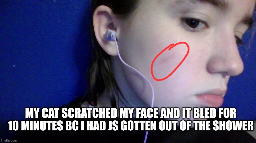 MY CAT SCRATCHED MY FACE AND IT BLED FOR 10 MINUTES BC I HAD JS GOTTEN OUT OF THE SHOWER | made w/ Imgflip meme maker