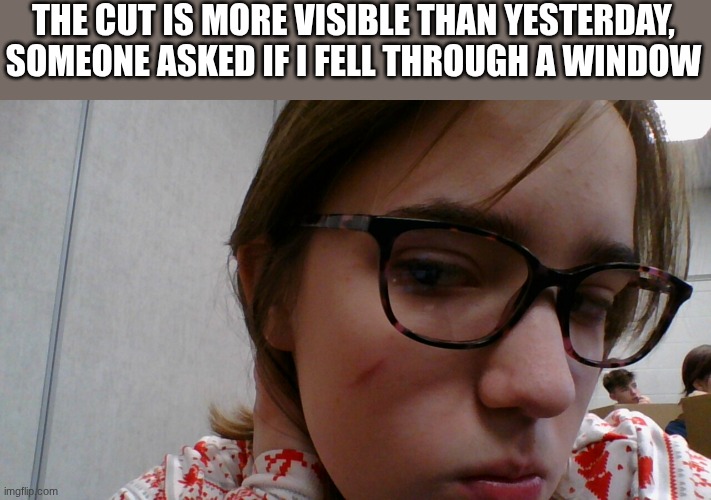 THE CUT IS MORE VISIBLE THAN YESTERDAY, SOMEONE ASKED IF I FELL THROUGH A WINDOW | made w/ Imgflip meme maker