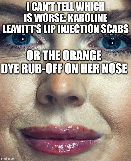 Just as fake as her press releases | I CAN'T TELL WHICH IS WORSE: KAROLINE LEAVITT'S LIP INJECTION SCABS; OR THE ORANGE DYE RUB-OFF ON HER NOSE | image tagged in karoline leavitt lip injections,plastic surgery,botox,fake news,donald trump | made w/ Imgflip meme maker