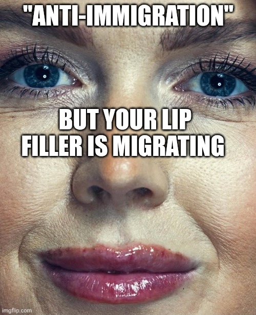 Her lip filler is made from cadaver butt fat | "ANTI-IMMIGRATION"; BUT YOUR LIP FILLER IS MIGRATING | image tagged in karoline leavitt lip injections,plastic surgery,immigration,fake people,maga | made w/ Imgflip meme maker