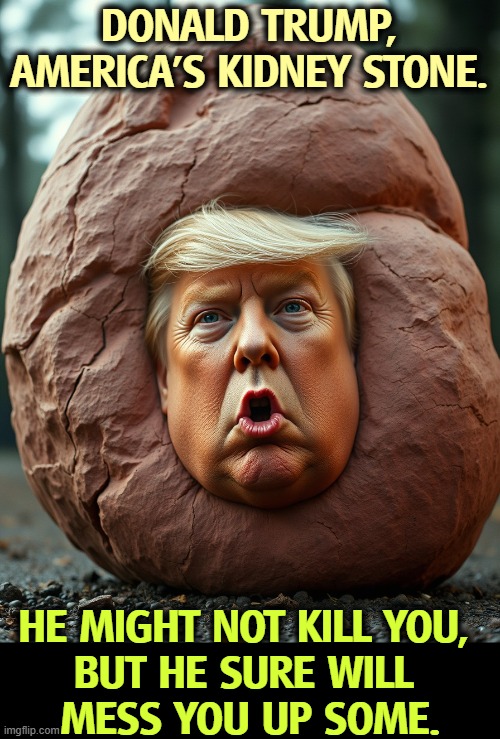 DONALD TRUMP, AMERICA'S KIDNEY STONE. HE MIGHT NOT KILL YOU, 
BUT HE SURE WILL 
MESS YOU UP SOME. | image tagged in trump,kidney stone,illness,disease,sickness | made w/ Imgflip meme maker