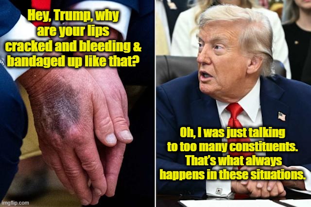 tRump is Not Well | Hey, Trump, why are your lips cracked and bleeding & bandaged up like that? Oh, I was just talking to too many constituents.  That’s what always happens in these situations. | image tagged in donald trump,nevertrump meme,trump memes,maga,presidential alert,trump is a moron | made w/ Imgflip meme maker