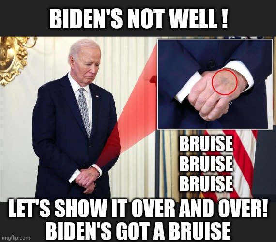 BIDEN'S NOT WELL ! BRUISE
BRUISE
BRUISE LET'S SHOW IT OVER AND OVER!
BIDEN'S GOT A BRUISE | made w/ Imgflip meme maker