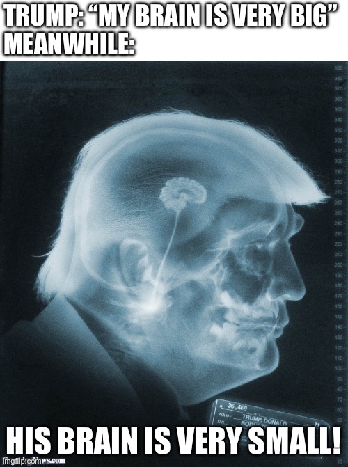 Trump brain moron Republican stupid x-ray JPP | TRUMP: “MY BRAIN IS VERY BIG”
MEANWHILE: HIS BRAIN IS VERY SMALL! | image tagged in trump brain moron republican stupid x-ray jpp | made w/ Imgflip meme maker