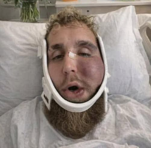 Jake Paul beaten Blank Meme Template